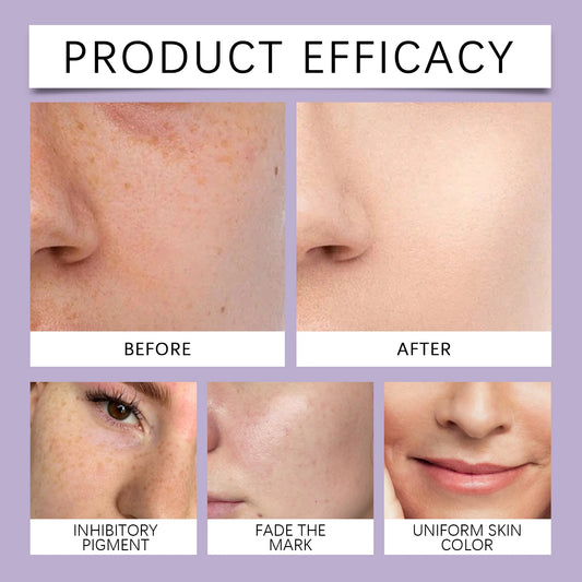 LumiSkin Retinol – Sérum Anti-Idade com Vitamina C e Niacinamida